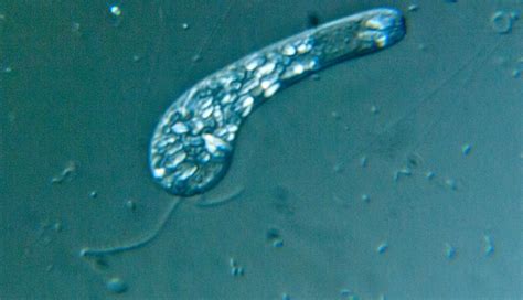  Dich Ciliate! A Tiny Wonder That Swims With Thousands Of Hair-Like Structures