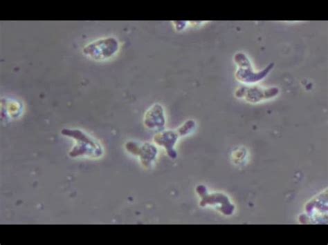  Naegleria Fowleri: Một Tạo Vật Siêu Vi Microscopic Lụa Bóng Có Thể Làm Bạn Phải Sợ Nước!